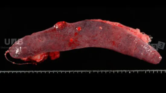 Semana del 14-nov-2025