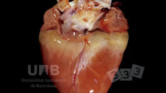 Semana del 14-nov-2025